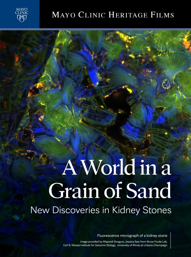 cover for the Mayo Clinic Heritage Films &amp;amp;quot;A World in a Grain of Sand: New Discoveries in Kidney Stones&amp;amp;quot;