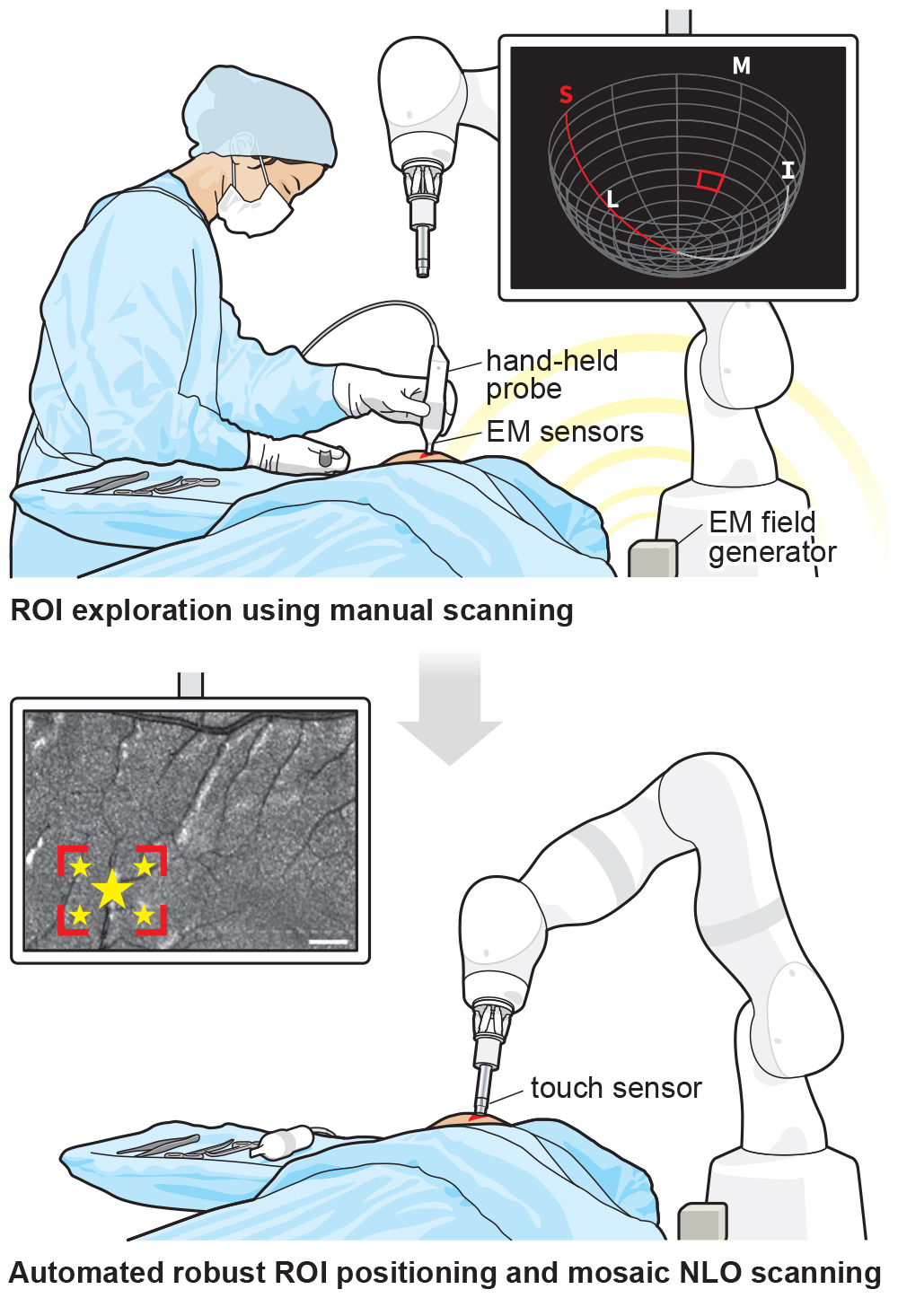 A two part figure showing the MarginDx system. 1. a surgeon holding a probe scans a tumor cavity. 2. the probe is shown mounted to a robotic arm to scan and classify tissue within the tumor cavity using AI.